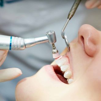 Professionelle Zahnreinigung bei einer Patientin