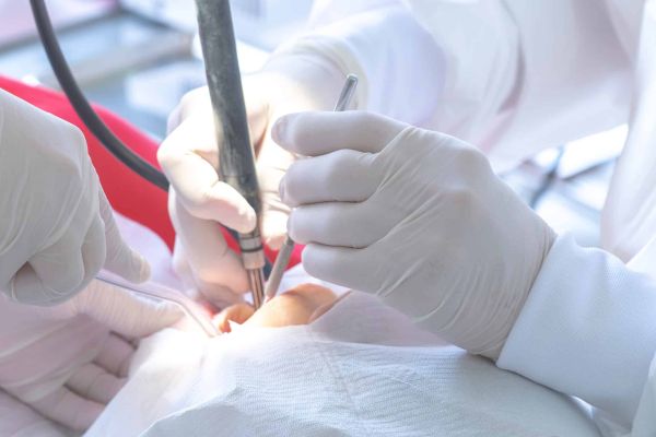Oralchirurgie: Hände mit chirurgischen Instrumenten